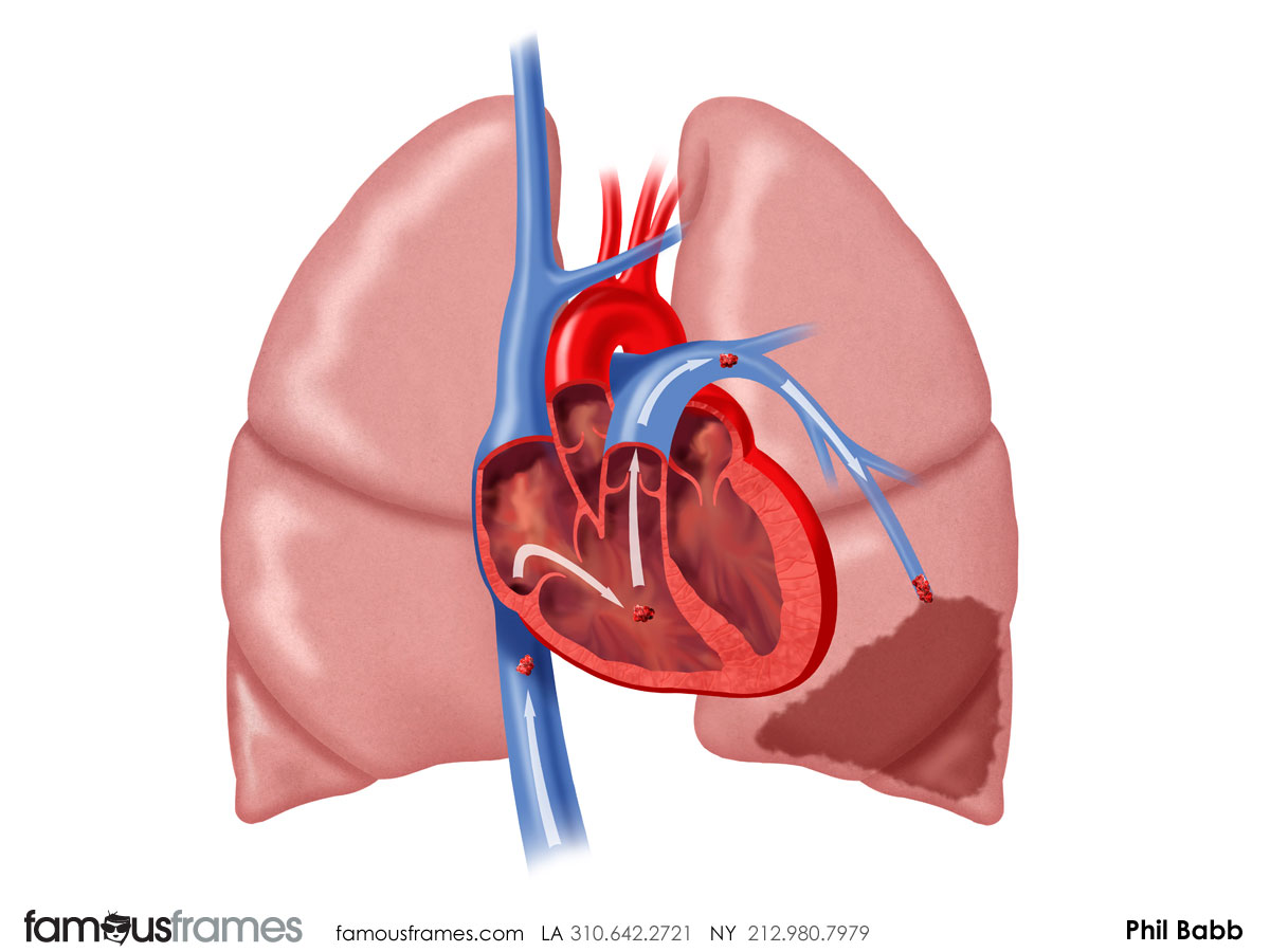 Phil Babb's Pharma / Medical storyboard art (Image #112_43_1364833458)