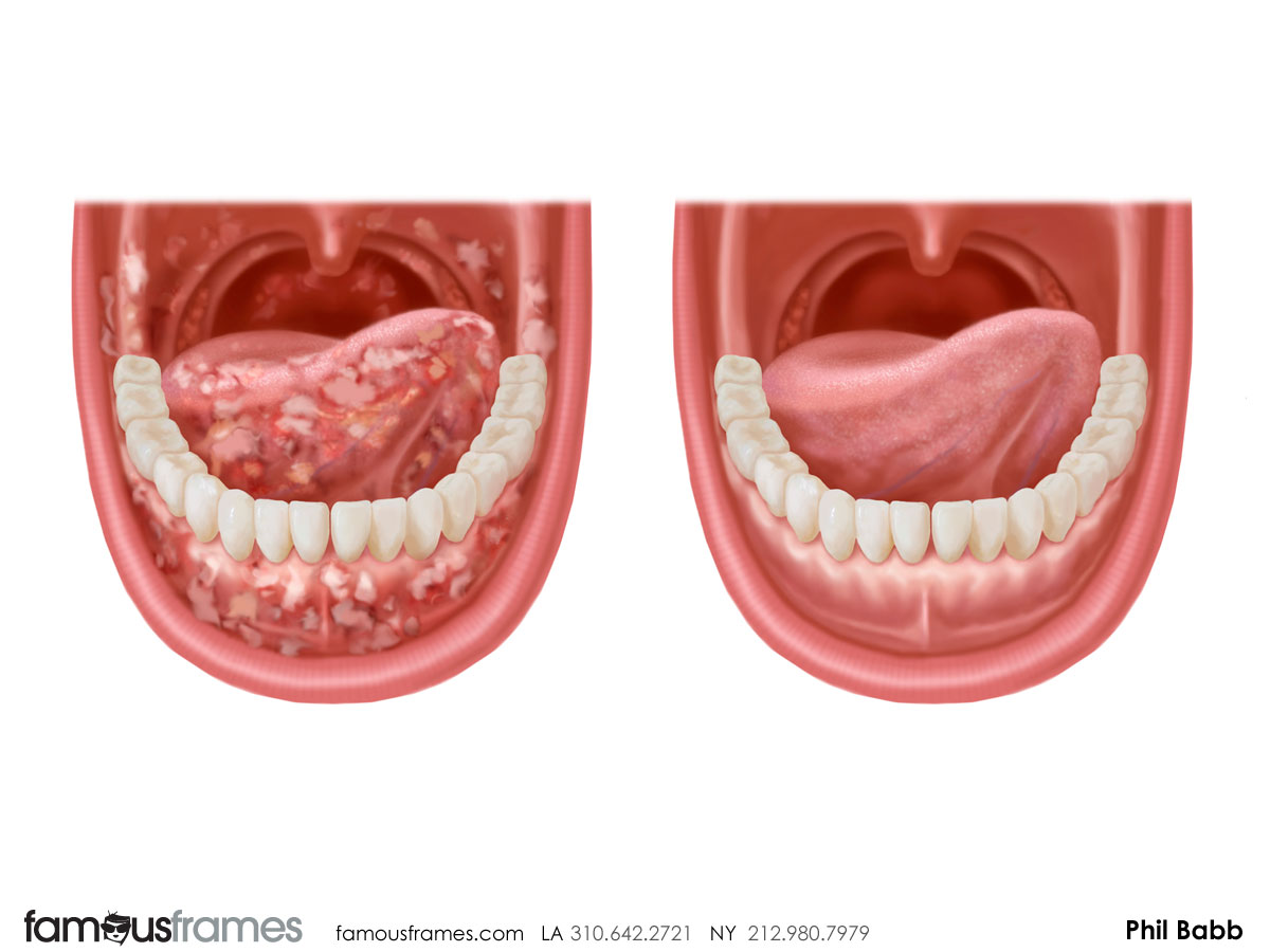 Phil Babb's Pharma / Medical storyboard art (Image #112_43_1364833470)