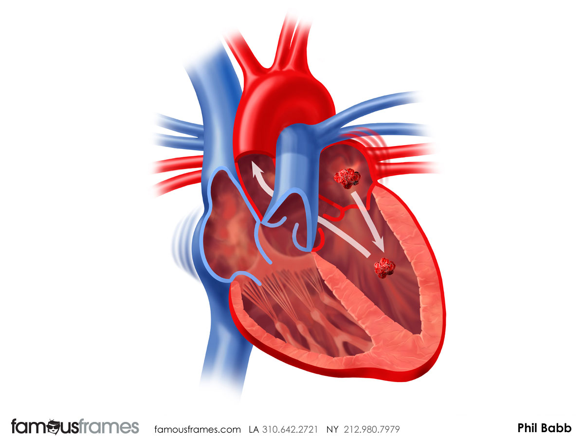 Phil Babb's Pharma / Medical storyboard art (Image #112_43_1364833610)