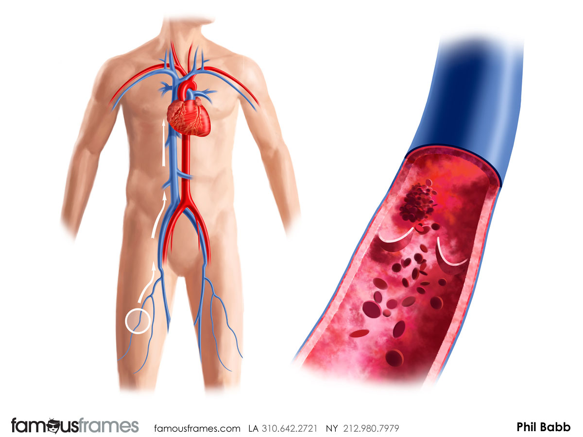 Phil Babb's Pharma / Medical storyboard art (Image #112_43_1364833647)