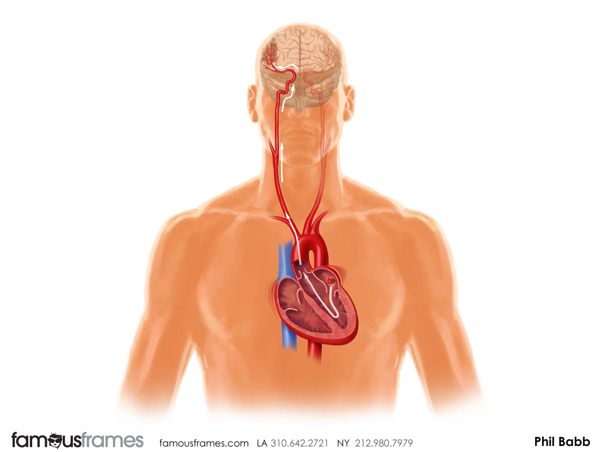 Phil Babb's Pharma / Medical storyboard art (Image #112_43_1364833657)