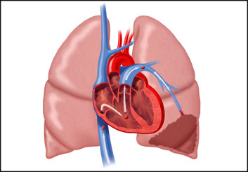 Phil Babb's Pharma / Medical storyboard art