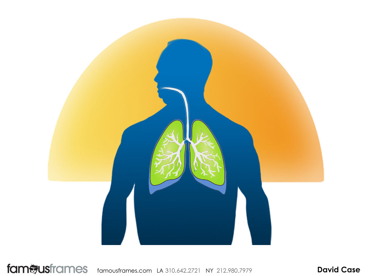 David Case's Pharma / Medical storyboard art (Image #314_43_1337127585)